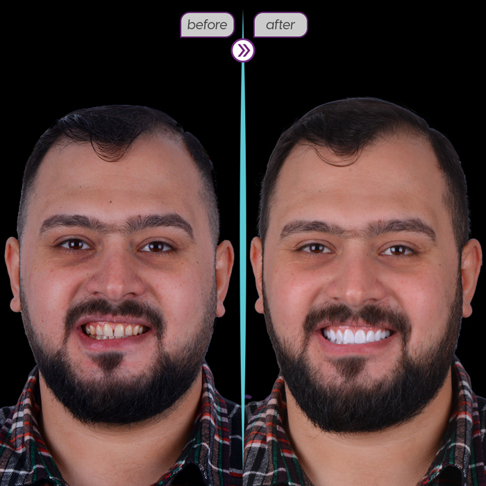 Smile case