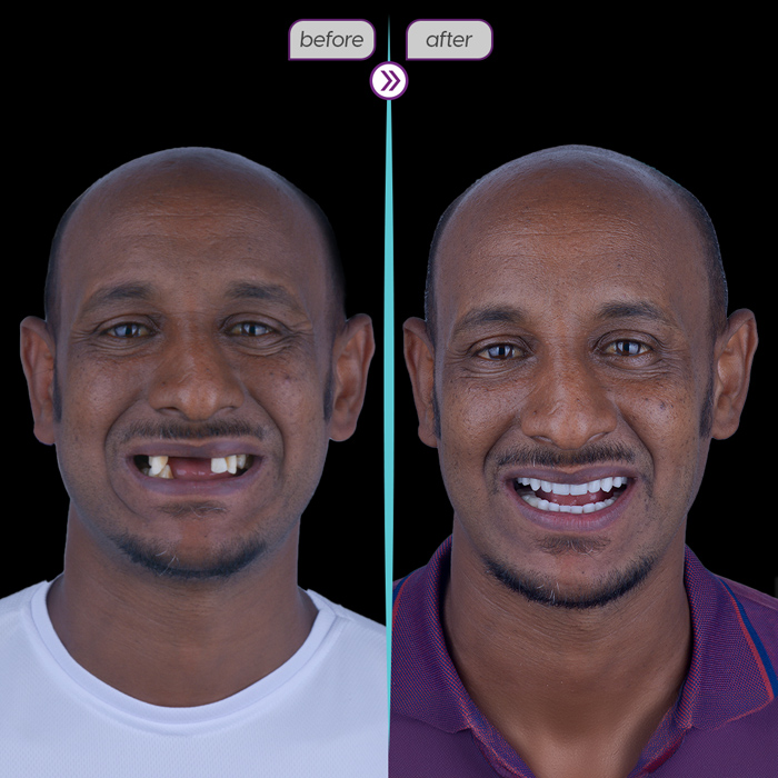Smile case