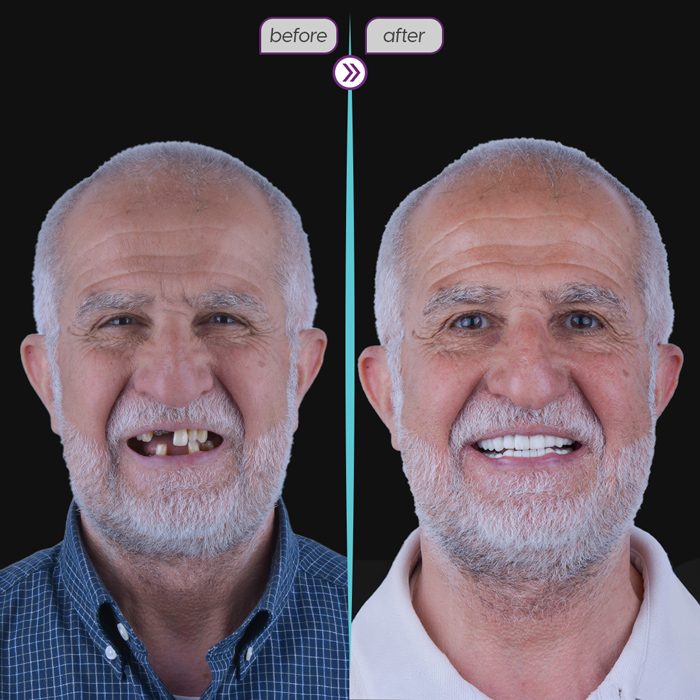Before after case